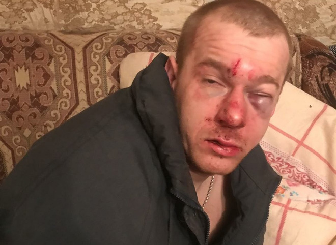«Мы едем вас убивать». Полиция Новомичуринска тормозит дело об избиении рязанца